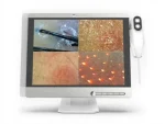 50 X 200 Magnification Full HD 15 Inch Screen Skin and Hair Analysis Device - Image 2