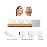 HF 020 (High Intensive Focus Ultrasound) Skin Care Device